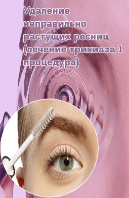 Лечение для ресниц
